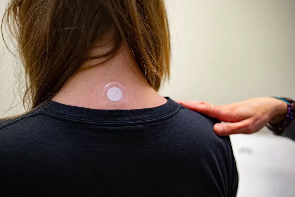 phototherapy patch on Du14